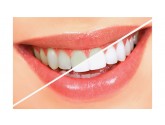 Perfect Smile Dental Clinic Marmaris